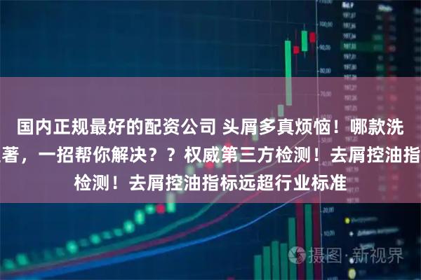 国内正规最好的配资公司 头屑多真烦恼！哪款洗发水去屑效果显著，一招帮你解决？？权威第三方检测！去屑控油指标远超行业标准